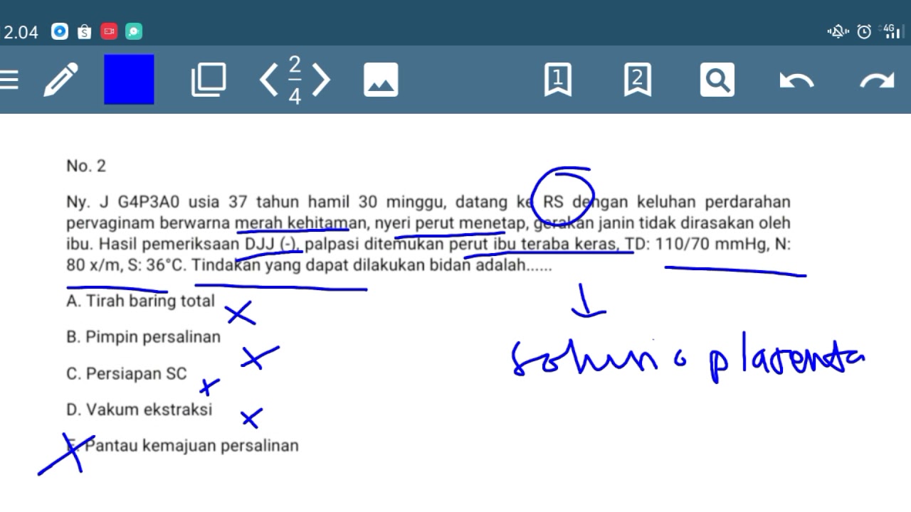 SOAL UKOM BIDAN !!! SOLUSIO VS PLASENTA PREVIA !! 💪