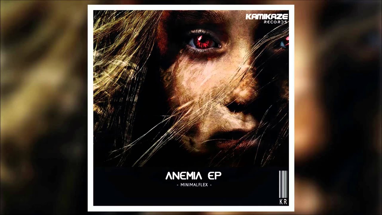 MinimalFlex - Anemia (Original Mix)