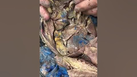 Cat Dissection Part 4: Organ Tour