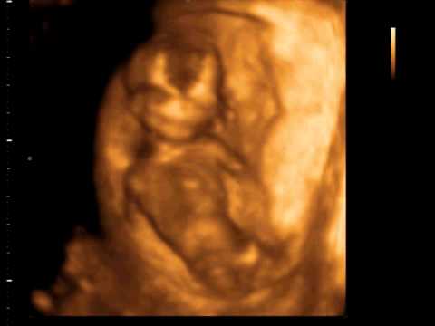 4D gender scan 16 weeks - YouTube