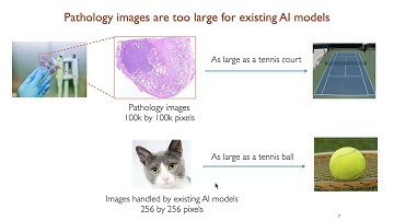 AI4H #10, Sheng Wang, Generative AI for Multimodal Biomedicine in pathology and retinal imaging