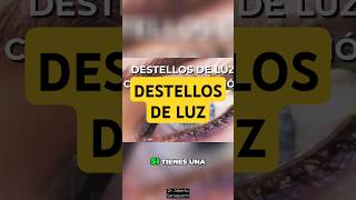 Destellos Luminosos  ¿Desprendimiento de Retina o Migraña