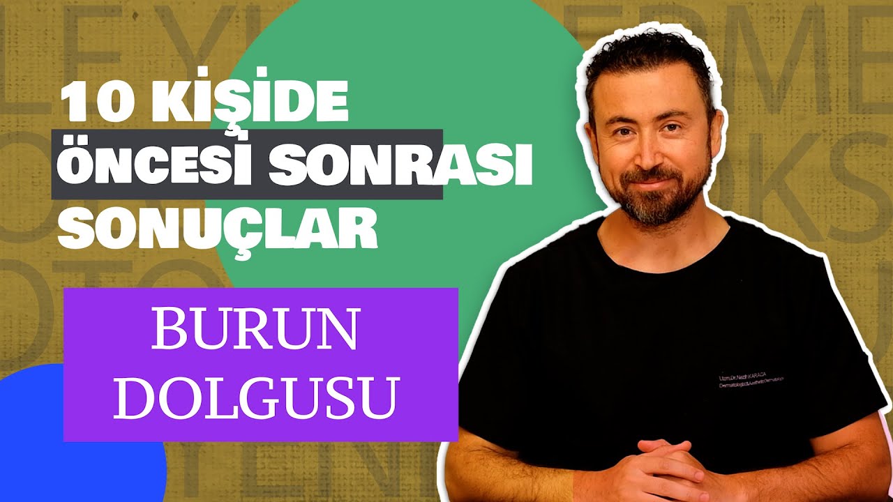 Burun Dolgusu: 10 hastada öncesi sonrası değerlendirme