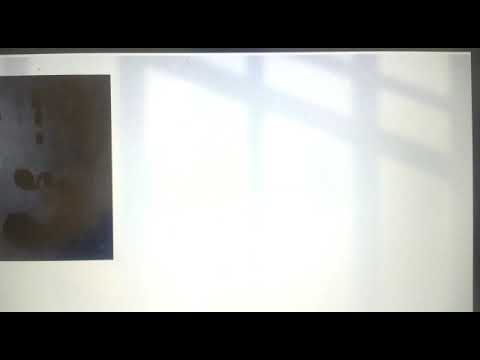 arthritis  cause  and Treatment