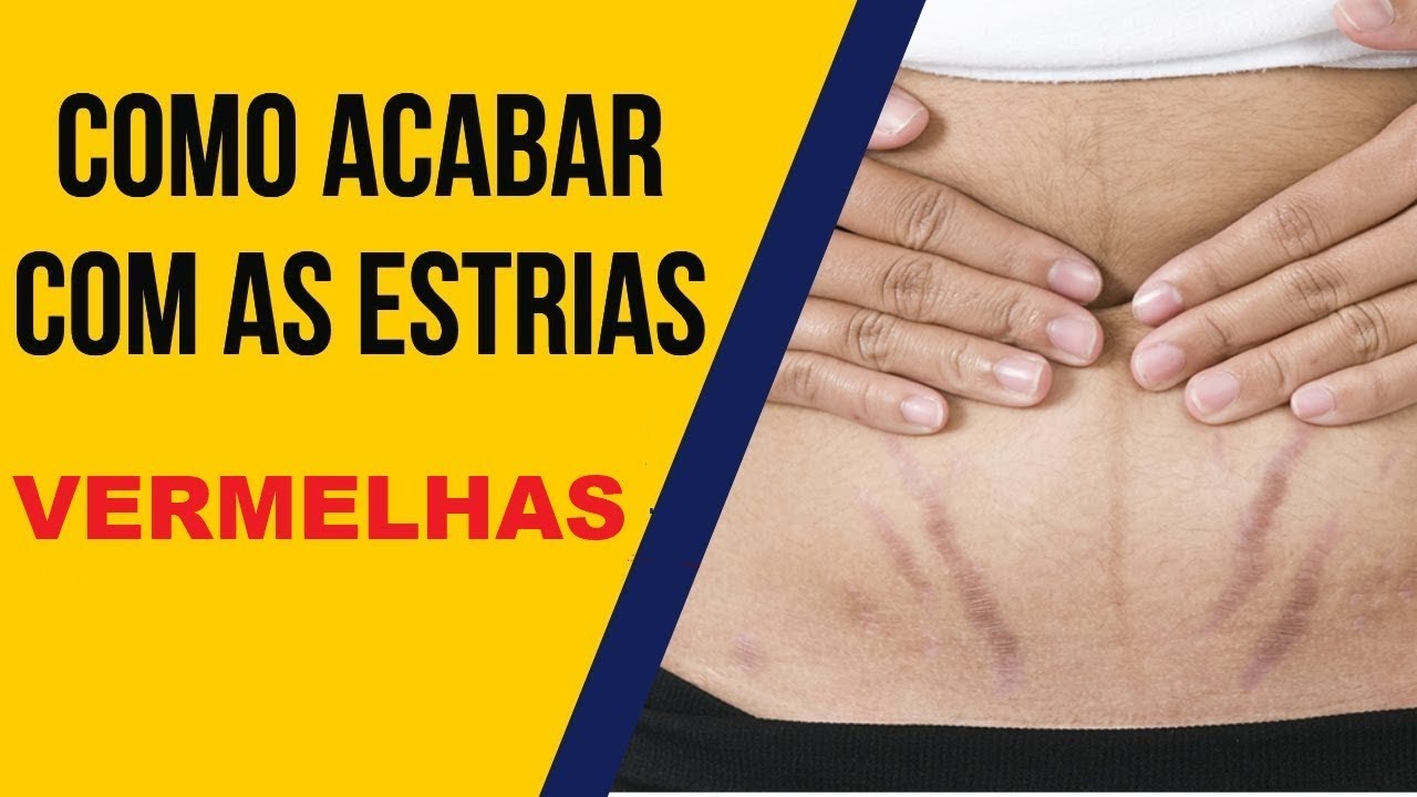 COMO TRATAR ESTRIAS VERMELHAS - TRATAMENTO NATURAL PARA ACABAR COM AS ...