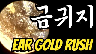 EP.168 금귀지 제거(Ear Gold Rush)