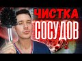 Атеросклероз артерий! Бляшки в сосудах! Чистка артерий!