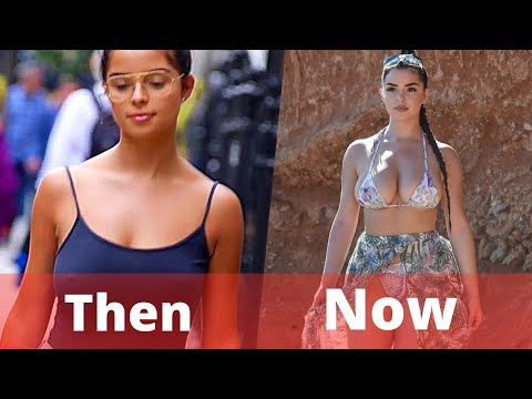 Demi Rose Before and After  Surgery