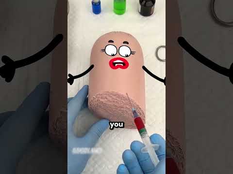 The Sausage Operation