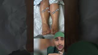 Can you tell what's going on with her leg? #dvt #deepveinthrombosis #venousinsufficiency #doctor