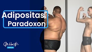 Übergewicht ist gesund? Das Adipositas-Paradoxon | Dr. Heart