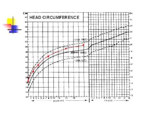 Newborn Head Circumference Chart