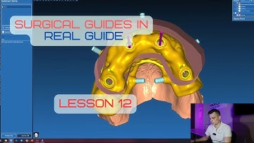 Surgical guides in RealGuide Tutorial. Lesson 12. Stackable guides,  All on 4. Part 2