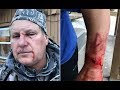 Man survives grizzly bear attack in Montana - Daily News