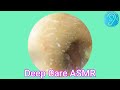 ASMR Ear Cleaning | Guaranteed Tingles and Instant Relaxation
