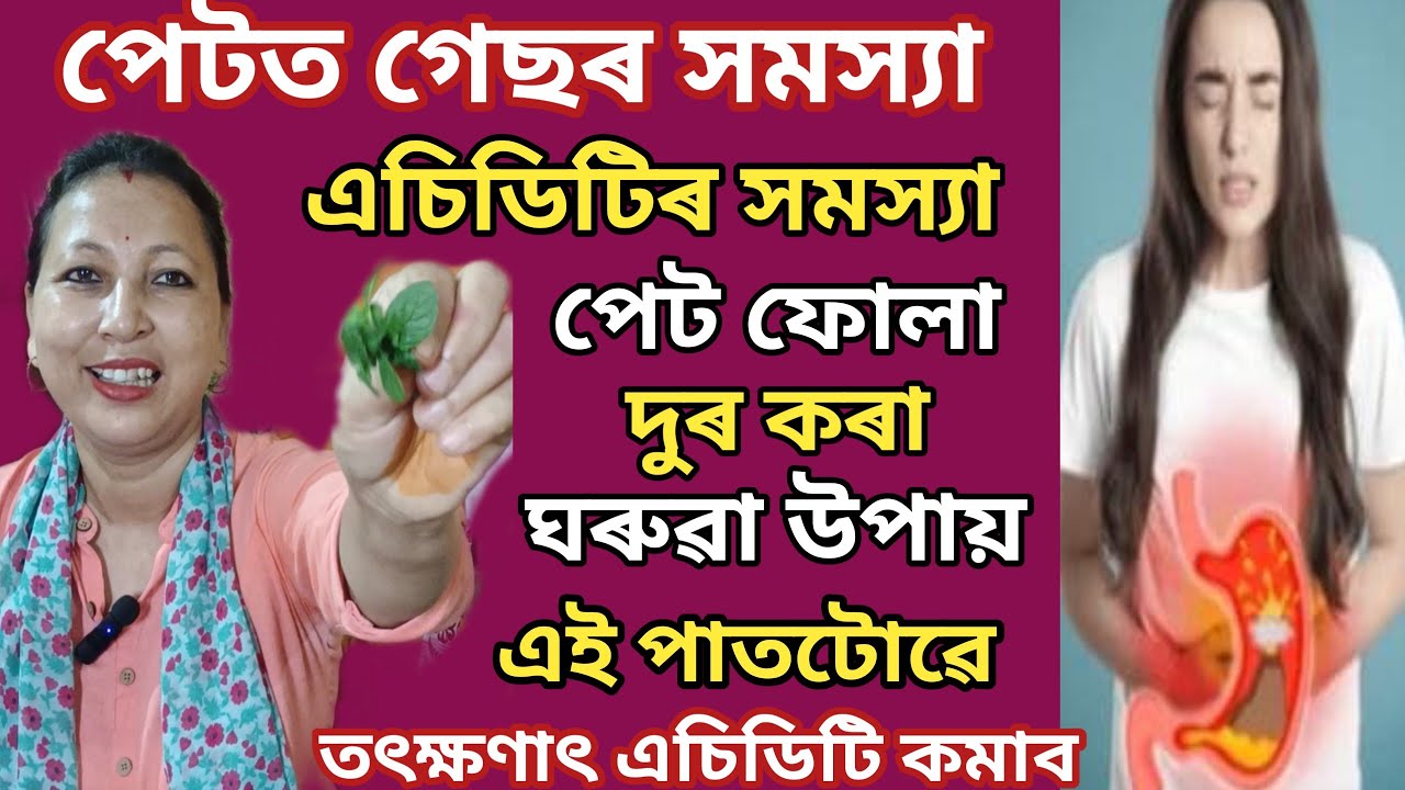 গেছ এচিডিটি সমস্যা তৎক্ষণাৎ দুৰ হ'বলৈ এই কেইটা কেইটা ঘৰুৱা উপায় কৰিব/ তৎক্ষণাৎ আৰাম পাব | vlog