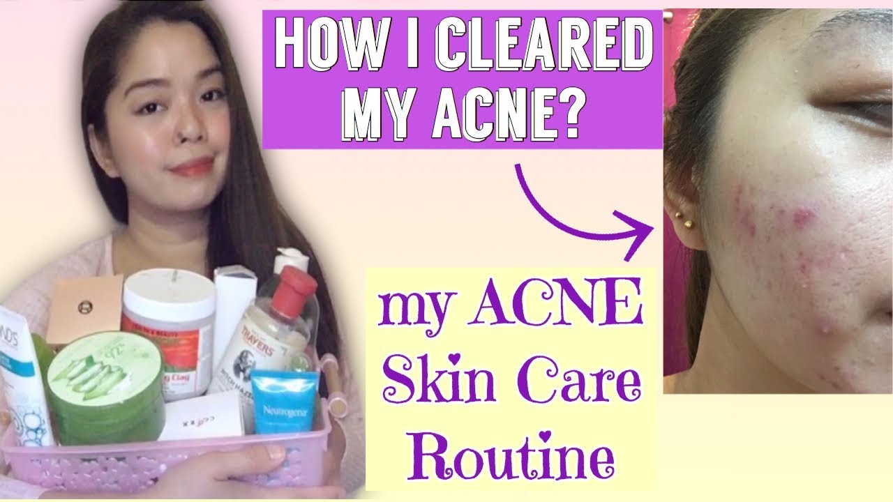 Affordable Acne Skin Care Routine For Oily Skin Youtube