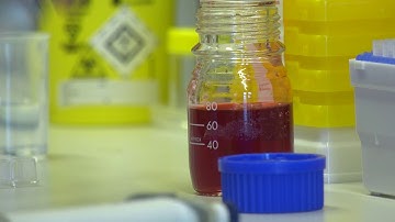 Joao Duarte – Linking cognitive impairment and diabetes