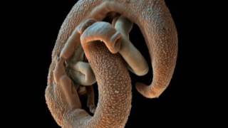 Monster Inside Me Brain Invasion