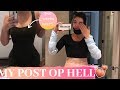 Post Op | BBL Experience *  Watch before you get a bbl! *