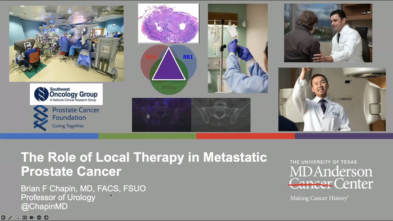 The Role of Local Therapy in Metastatic Prostate Cancer