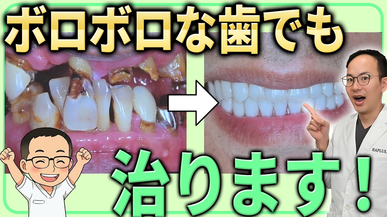 歯が崩壊してしまっていても諦めないで!ボロボロな口腔内から綺麗な歯を手に入れた症例を沢山紹介します!