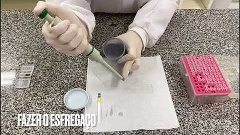 COMO FAZER O EXAME DE ESPERMOGRAMA