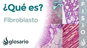 ¿Cuál es el sistema de los fibroblastos?