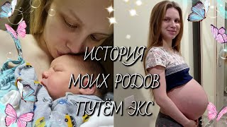 картинка: 🩵МОЯ ИСТОРИЯ РОДОВ! КЕСАРЕВО СЕЧЕНИЕ.🩵
