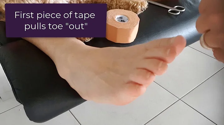 How To Hold A Curly Pinky Toe Straight With Tape