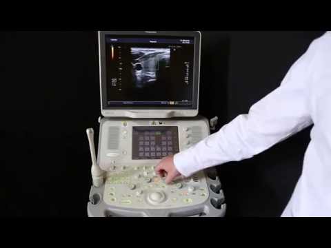 Power Doppler enhancement