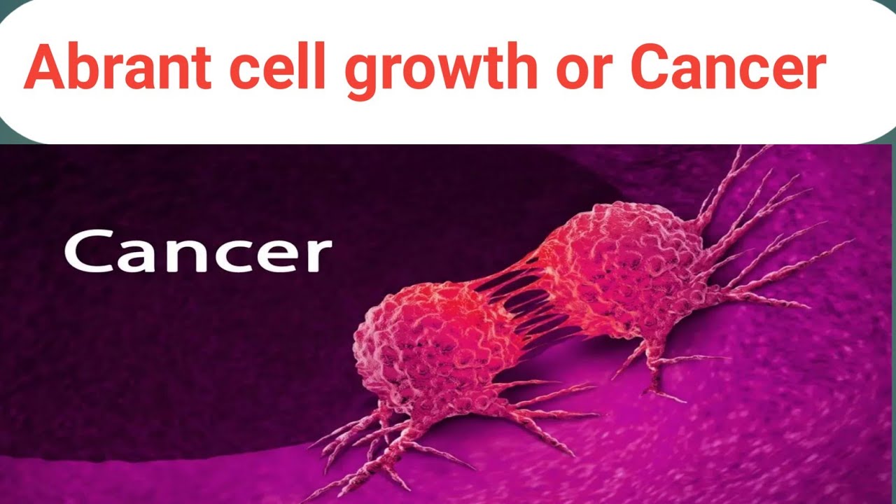 cellular adoption abrant cell growth/cancer chapter: 3 pathophysiology part: 2 kmu slides in pashto