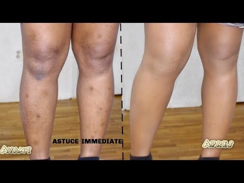 Vidéo: Comment créer de la crème pour obtenir des jambes parfaites : 12 étapes
