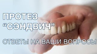 Что такое сэндвич протезы? Особенности протезирования, плюсы и минусы