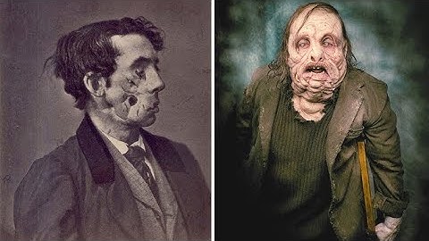 15 Bizarre Mensen Die Er Te Onwerkelijk Uitzien Om Menselijk Te Zijn