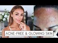 HOW I MAINTAIN ACNE-FREE GLOWING HEALTHY SKIN | Annie Jaffrey