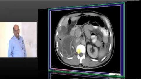 NEETPG Coaching Image Based MCQ