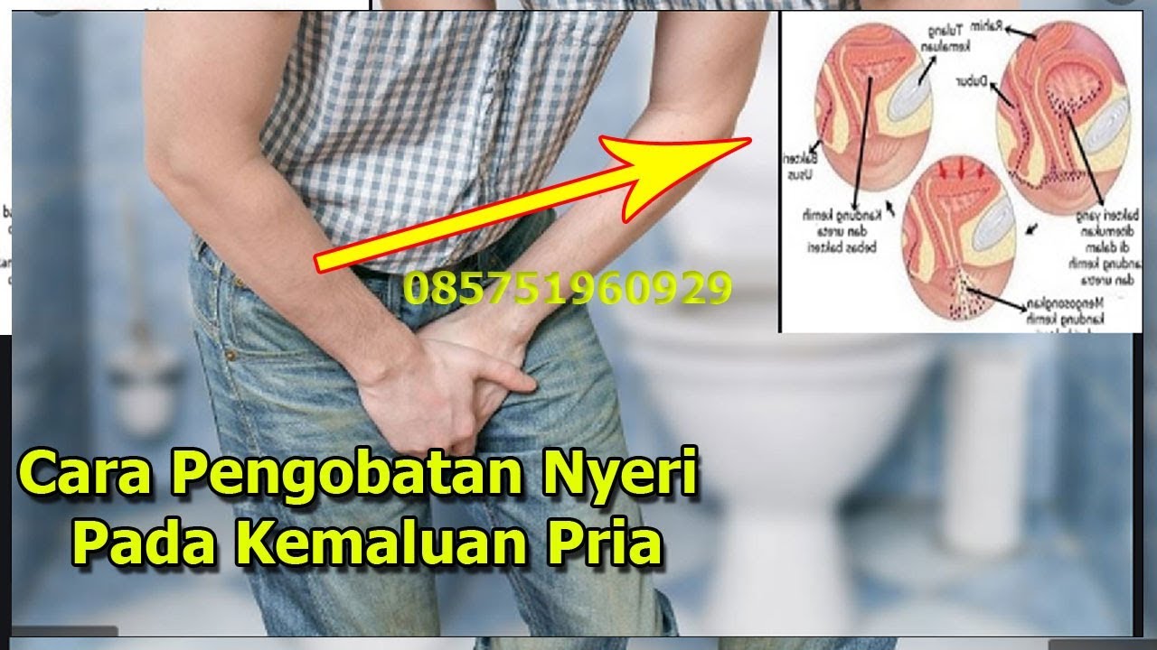 Penyebab Dan Cara Mengatasi Penis Sakit Pada Kemaluan Laki Laki Youtube