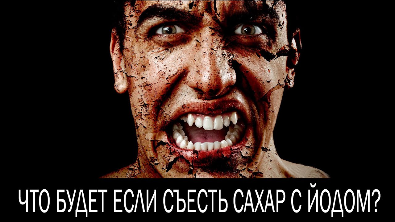 Что будет если съесть сахар с йодом