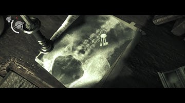 The Evil Within: The Patient | Valerio Gameplay Part 7 (Xbox One, PS4)