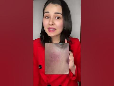 Что будет с кожей, если плохо смывать макияж? - YouTube