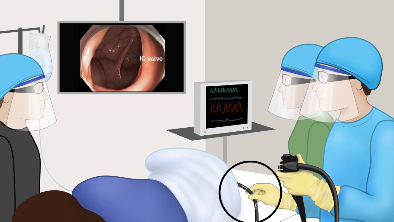 Colonoscopy EMR Tip Short Scope Critical for EMR YouTube