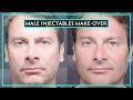 Complete Injectables Make-Over On A Man