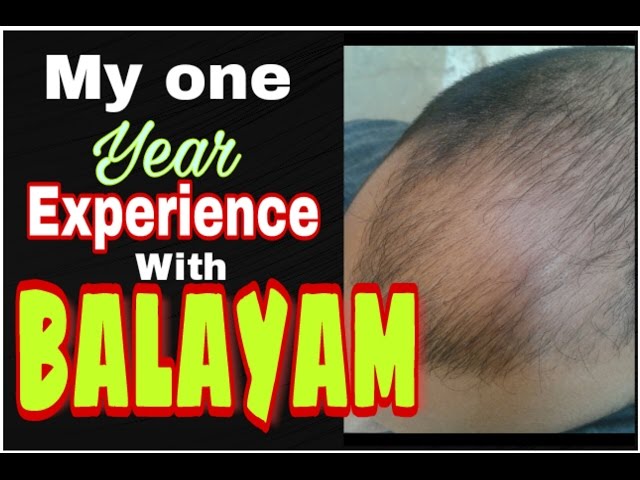 Arham Health Retreat  BALAYAM MUDRA Hair regrowth hairfall thinning of  hair headache calms mind etc The name is quite selfexplanatory The  ancient Indian practice of Yoga refers to nail rubbing as 