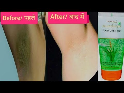 हर लड़की को पता होना चाहिए Underarms को गोरा करने का तरीका | सिर्फ 2 मिनट में / Underarms Whitening