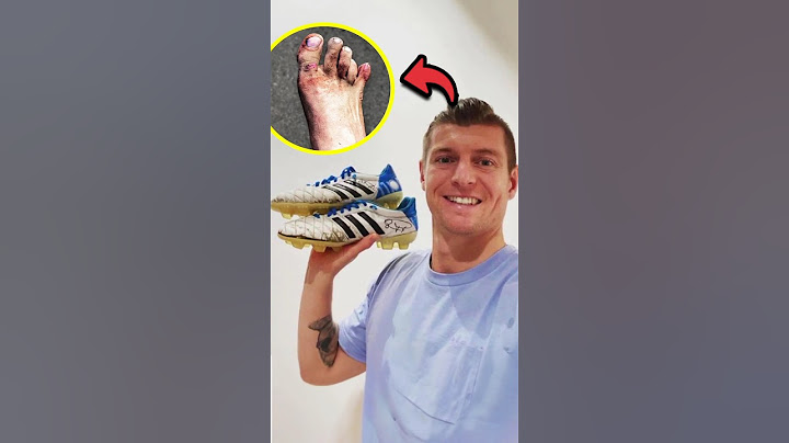 La increíble historia de Toni Kroos y los legendarios zapatos Adidas 👟✨⚽