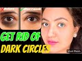 7 DAYS CHALLENGE : DIY SERUM To Remove DARK CIRCLES PERMANENTLY in 1 WEEK |  Preity प्रेरणा