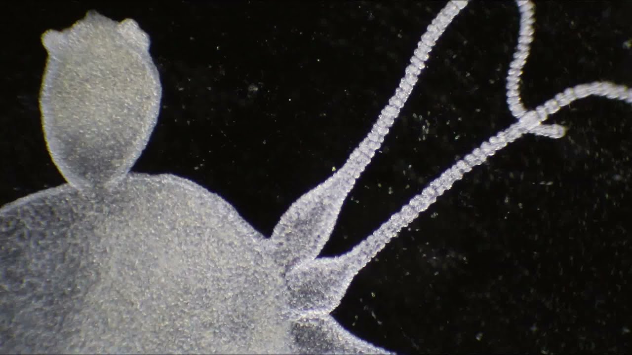 #36.2 Hydra vulgaris in dark field