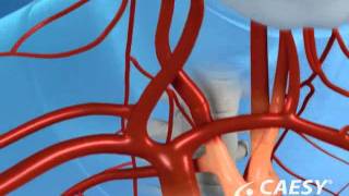 Periodontal Disease Systemic Effects Cardiovascular Health