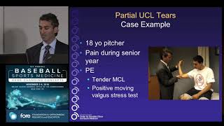 Partial Tears & Non-Operative  Treatment of Elbow UCL Tears